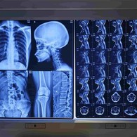 पारंपरिक एक्स रे फिल्म